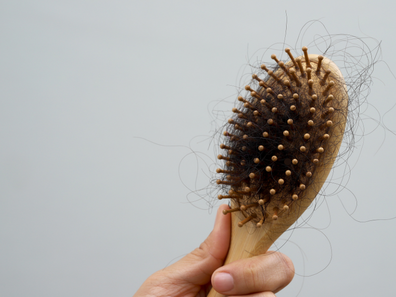 queda de cabelo devido a saúde hormonal